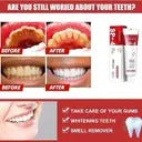 Teeth Whitening Paste Ultra SP-4