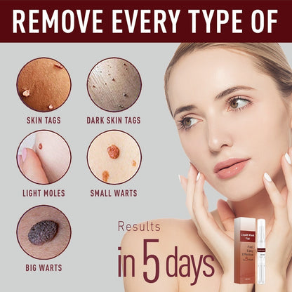 Body Wart Remove Pen